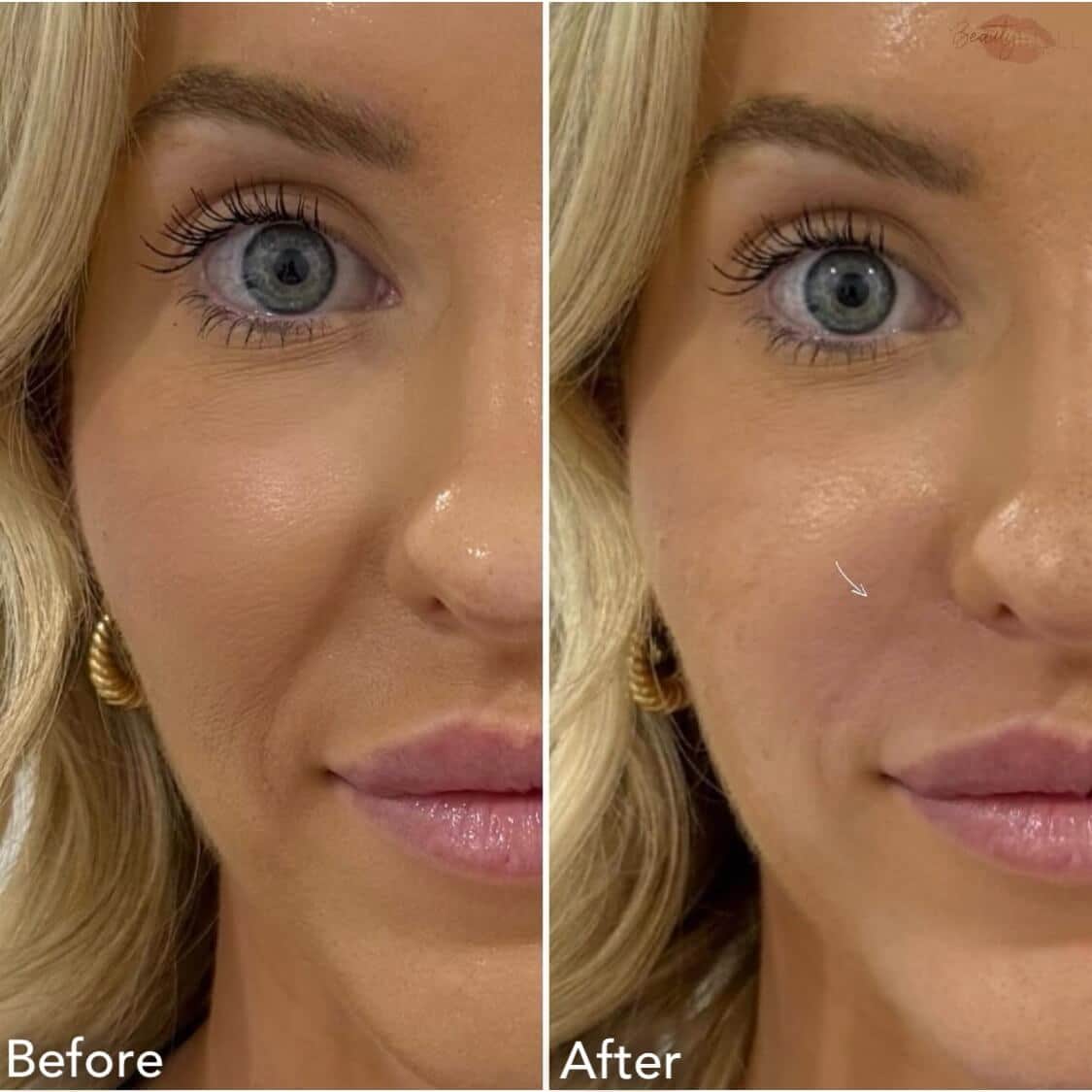 Comparison of skin appearance before and after treatment